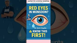 Why Eyes Turn Red in Monsoon 🌧️ | Dr. Amit Gupta