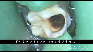 ドックベストセメント 3mix でも治らない症例をＭＴＡで治療し治す！