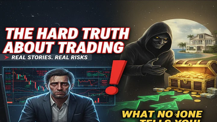 The Hard Truth About Trading What No One Tells You! 