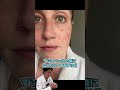頬に4週間続いた炎症性の出来物を手術で切除! 皮膚科医のたかし先生が解説!
