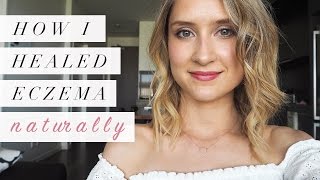 How I Healed Eczema Naturally | My Story