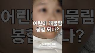 어린이 개물림 상처 과연 봉합이 가능할까? 성형외과 어린이 상처 봉합 [아문TV]