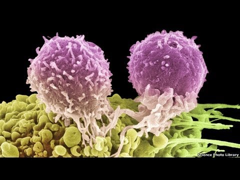 السرطان أسبابه وعلاجه حقائق ومعلومات