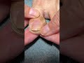 Toe Nail Fixer| Ingrown Toenail Cleaning & Care #ToenailFix #NailCare #FootCare #PedicureClean
