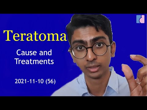 Video: Teratoamele ovariene sunt canceroase?