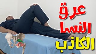 تمرين واحد لعلاج عرق النسا الكاذب piriformis syndrome