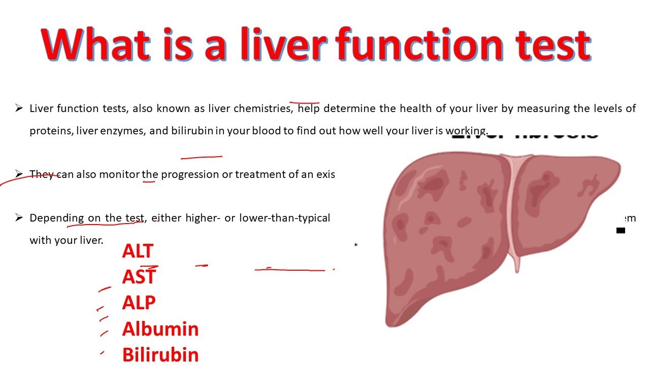 Liver Function Test Explained Alt Ast Alp Albumin Bilirubin Test