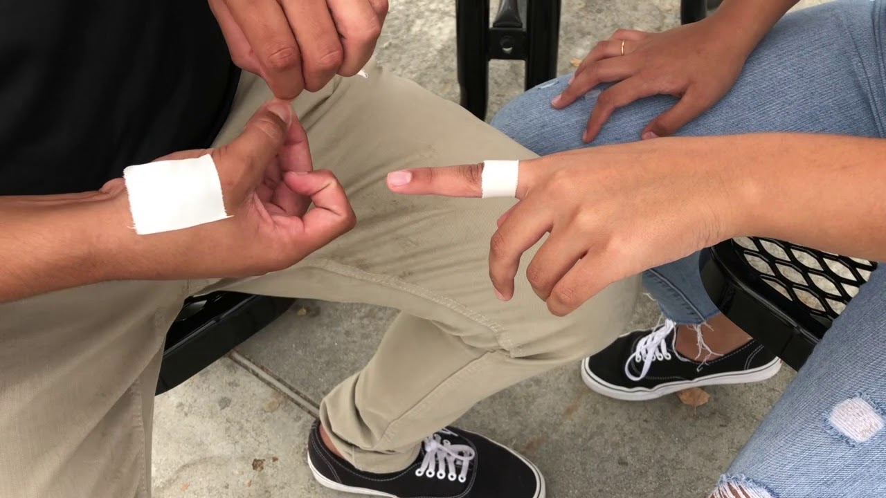Sports Medicine Finger Taping Video