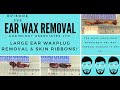 LARGE EAR WAX PLUG REMOVAL AND SKIN RIBBON - EP395