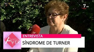 Hablamos con una afectada por el Síndrome de Turner | Vamos A Ver