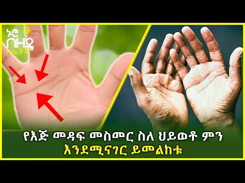 ቪዲዮ: የራስ መስመር ምንን ያሳያል?