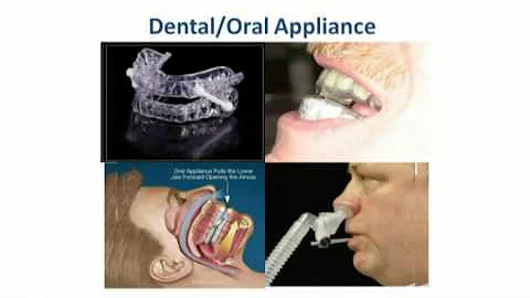 Stop Snoring Lecture Highlights - Dr. Salah Lababi...