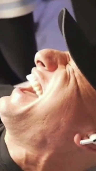 Steve and 6IX9INE getting a questionable surgerie😂#stevewilldoit #viral #shorts #reels #nelk