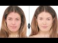 How to cover up Acne: Charlotte Tilbury Magic Foundation Makeup Tutorials