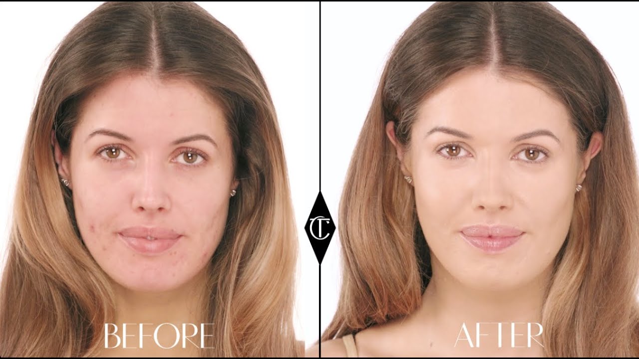 How To Cover Up Acne Charlotte Tilbury Magic Foundation Makeup