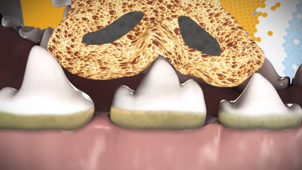 pedigree dentaflex large