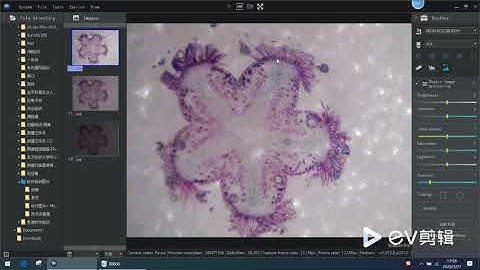 What is denoise of microscope imaging
