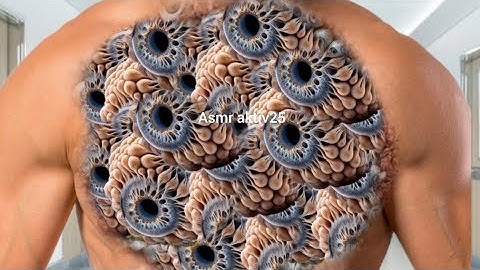 ASMR Pier Treatment Animation | ASMR Remove Maggots Kida from chest | ASMR Deep Cleaning