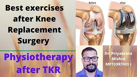 Physiotherapy after Total Knee Replacement Surgery...