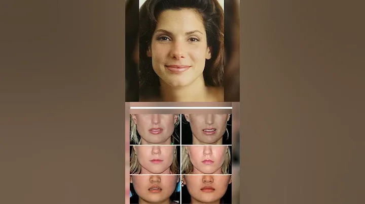 Did Sandra Bullock have Plastic Surgery?