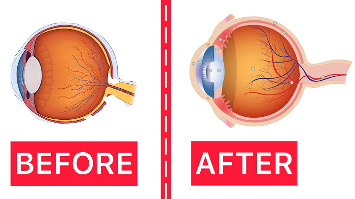 10 Great Exercises To Improve Your Eyesight | Eye Correction Exercises | Tips For Heathy Eyes