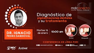 Conferencia en línea: Diagnóstico de pigmentaciones dentales y su tratamiento