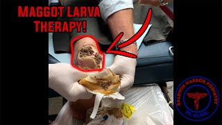 Dr. Kilfoil Performs Maggot Therapy! (Live Maggots In Foot!)