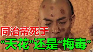 同治帝死於“天花”還是“梅毒”？