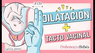 ¿Cómo se dice dilacion o dilatacion?