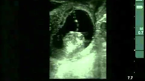 Cow #4539 Day 63 of Gestation