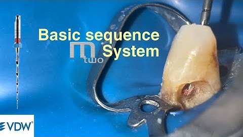 Mtwo system basic sequence (vdw)