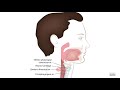 HCC 1475-2f2-Pathology of Esophagus - Zenkers diverticulum