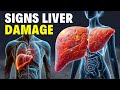 10 Weird Signs You Already Have LIVER DAMAGE 👩‍⚕️