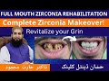 Full mouth rehabilitation with zirconia crown for instant smile makeover in hindiurdu 2023