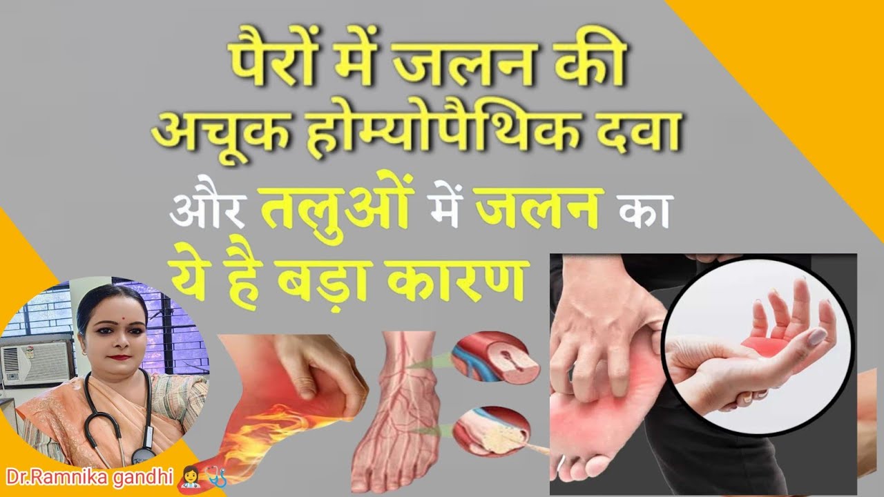 पैरों में जलन का होम्योपैथिक इलाज व दवा Homeopathic medicine and