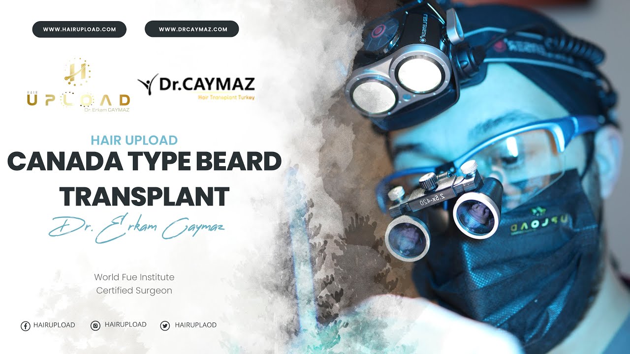 Canada Type Beard Transplant mp4
