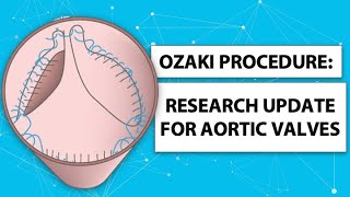 Ozaki / AVNeo Procedure: What Should Patients Know?