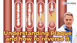 Understanding Plaque and how to reverse it screenshot 4