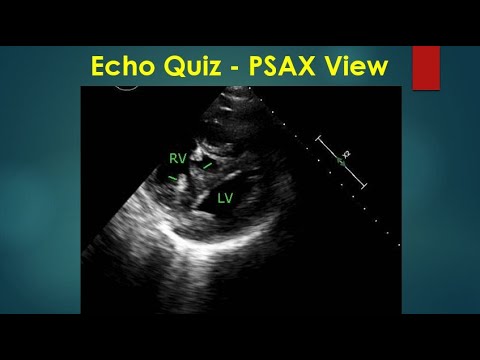 Echo Quiz -