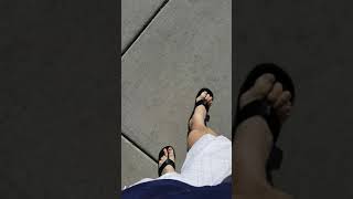 Toe Amputee Walking