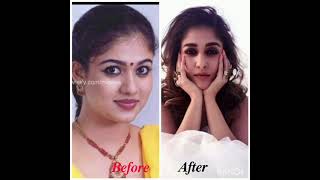 Actress before and after plastic surgery {part 1}| shorts | cine finding
