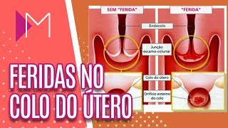 Tocar ao nuca machucado sente-se