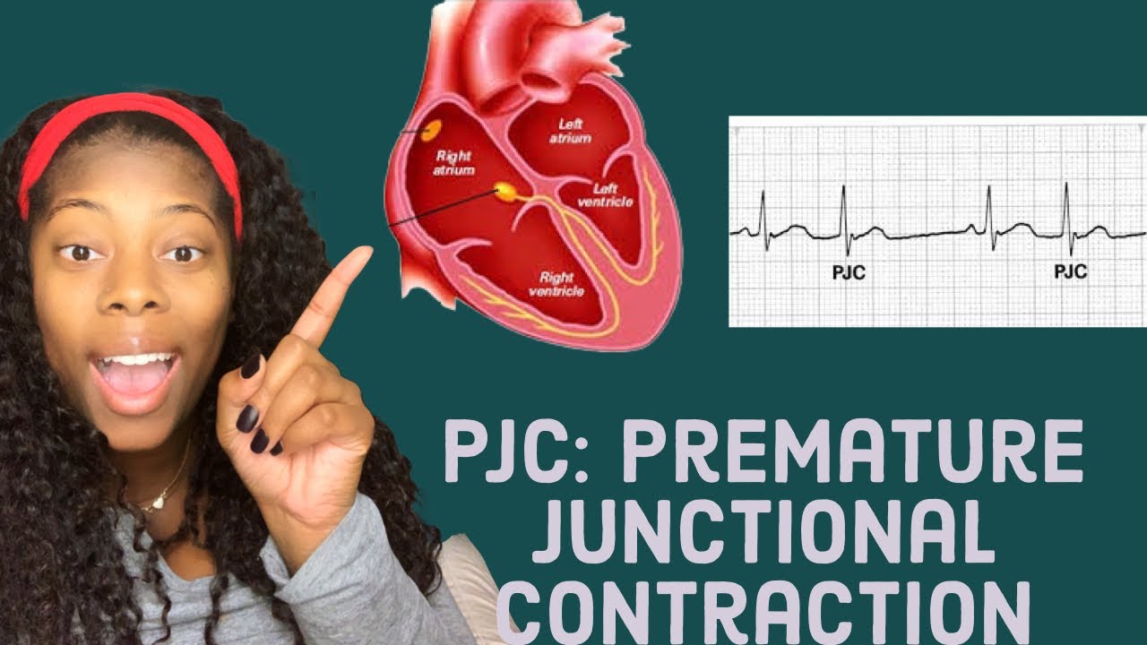 Basic EKG: Identifying premature junctional contractions- PJCS - YouTube