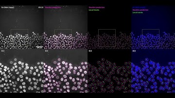 ZeroCostDL4Mic Video #4: Stardist to segment nuclei and TrackMate to automatically track migration