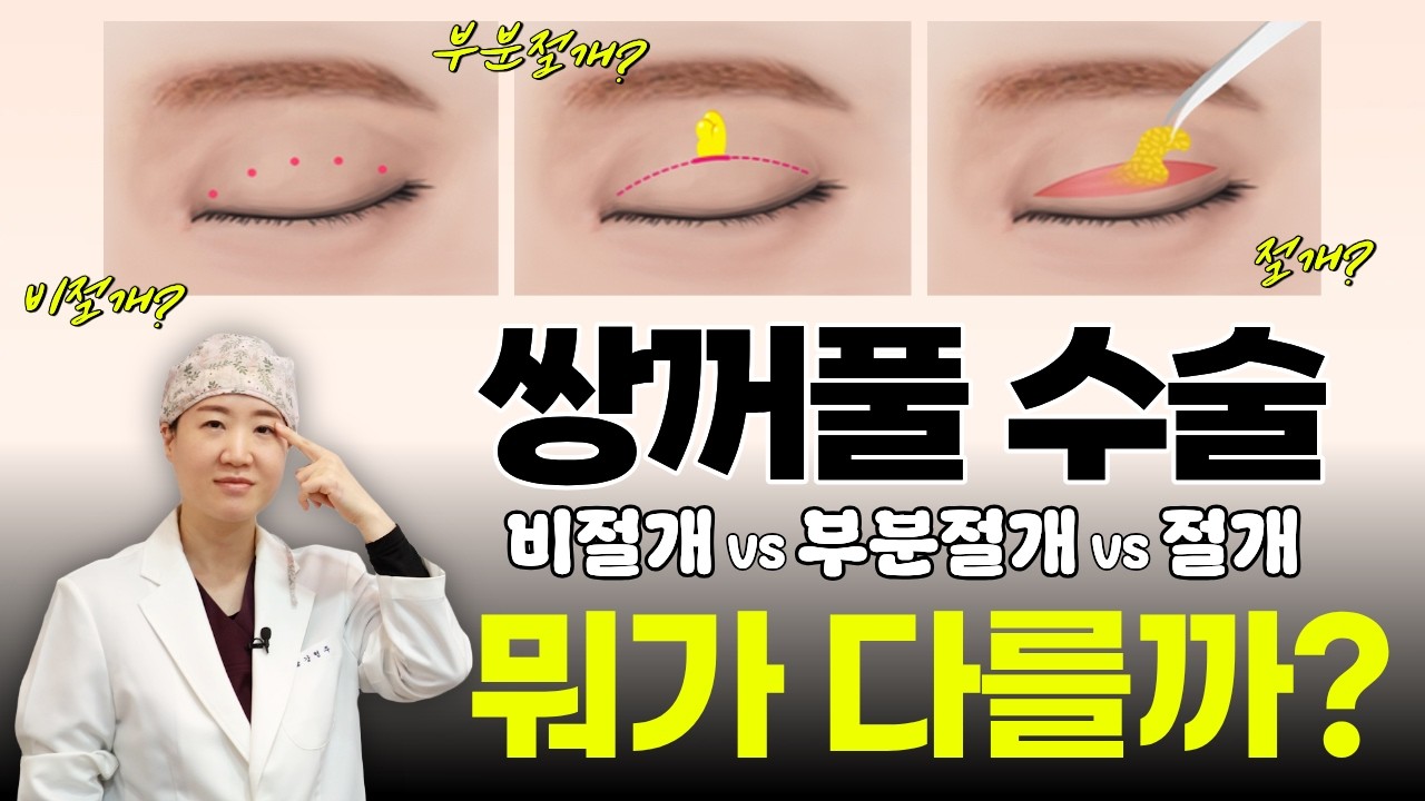 #눈성형 #눈수술 #쌍꺼풀수술 #쌍수 #절개 #비절개 #부분절개#쌍꺼풀라인 #강형주 #제이준성형외과피부과 