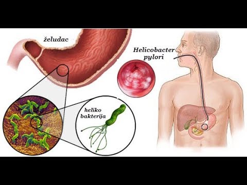 Video: Djeluje li septičko liječenje doista?