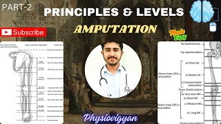 Levels of Amputation ll Principles of Amputation ll Amputation ll Types of Amputation