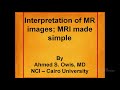 Interpretation of mr images mri made simple i