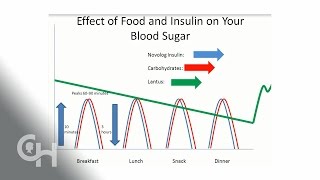 Basal/Bolus insulin and Carbohydrates