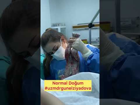 Normal Doğum(vaginal doğum,doğuş,vaginalbirth)